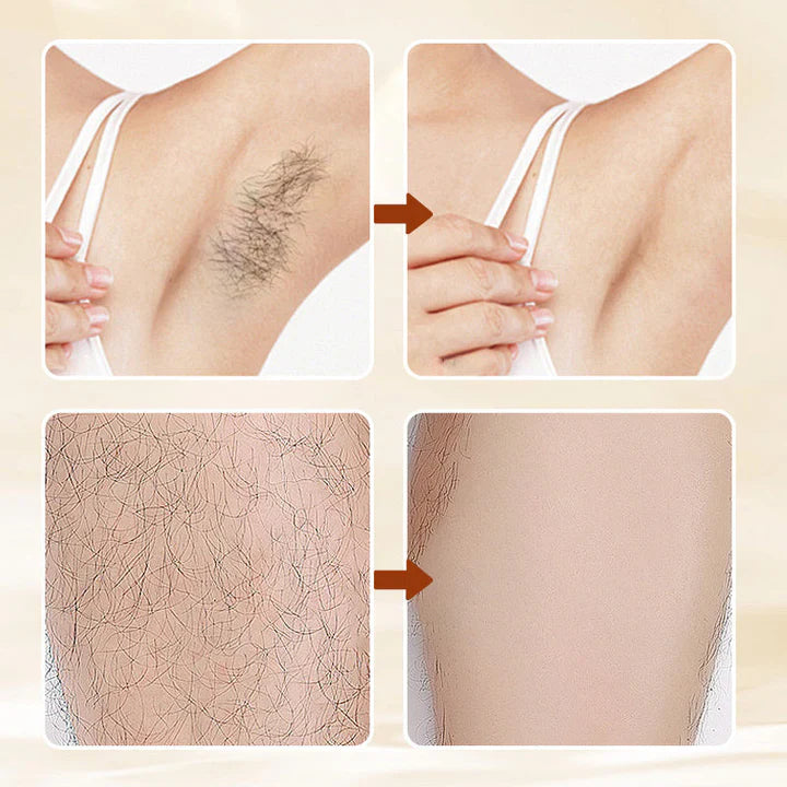 Hair Erase – Gentle Hair Removal Cream